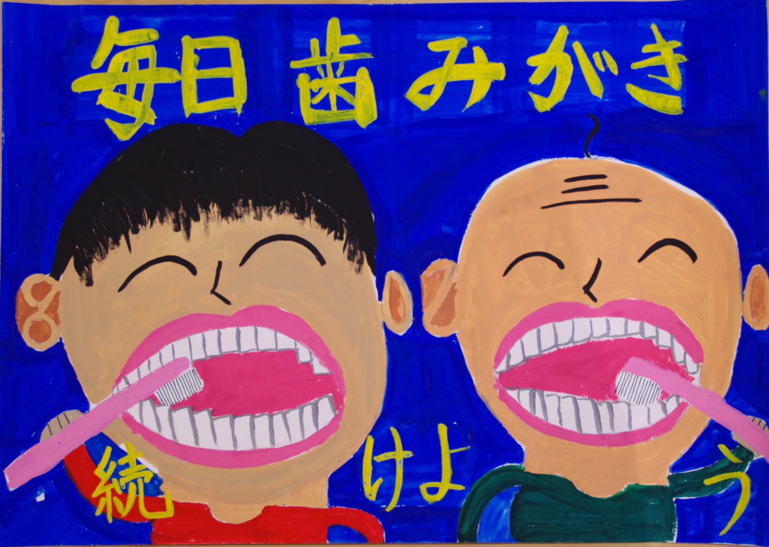 拡大画像